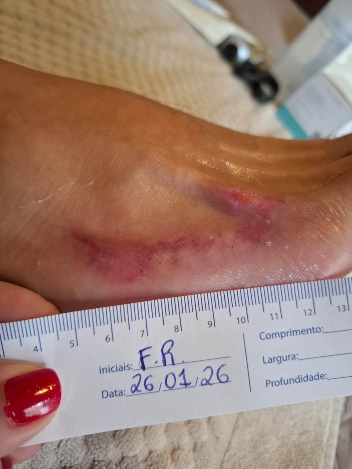 Após 29 dias