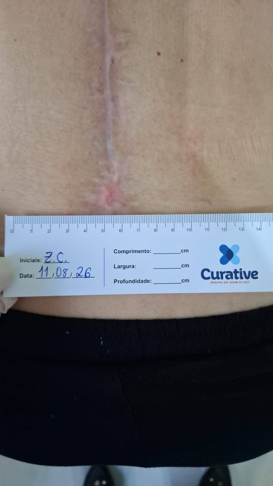 Após 3 meses